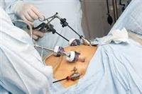 Clinical examination before a mammogram