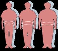 Obesity
