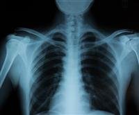 How X-rays work