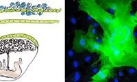 High-risk pregnancy: The interferon effect
