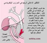 منظار فحص القناة الصفراوية والبنكرياس