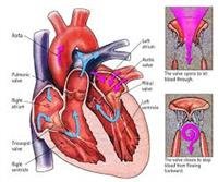What Is Mitral Valve Surgery?