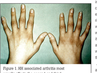 Hereditary Hemochromatosis