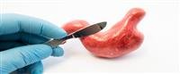 Late stages of pancreatic cancer early