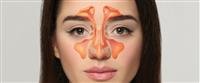 Sinus surgery: how is it performed?,
