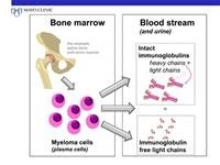 Multiple myeloid cancer