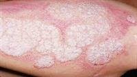 Dermatological examination