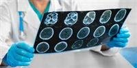 MRI ,