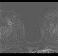 Top 10: Most Read Radiology Technology Content