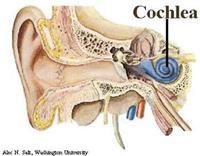 Cochlear implants Risks