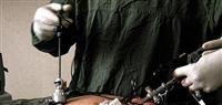Laparoscopic surgery.