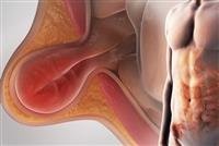 Anemia