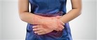 Intestinal obstruction