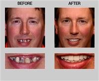 What is restorative dentistry?