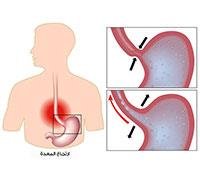 Celiac