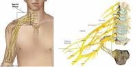 Misdiagnosis may cause unnecessary surgery