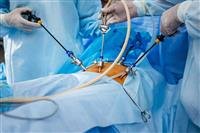 Laparoscopy..