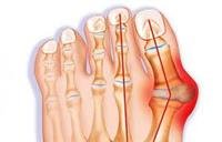Is surgery the only solution to the deviation