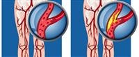Abdominal surgery