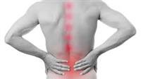 Spondyloarthritis.