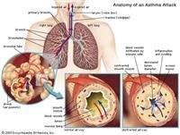 Many Docs Order Unneeded Lung Cancer ScreeningTest