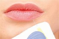 "Filling injection" for face beautification ..