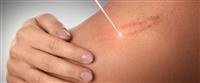Impotence, the most dangerous complication of