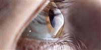 Keratoconus: Causes, symptoms and 10 treatment opt