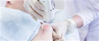 10 Essential Facts About Ebola