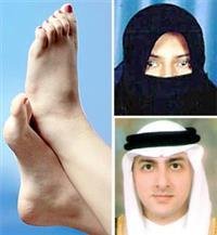 Foot gangrene threatens to amputate limbs in