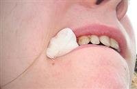 Dislocated Teeth