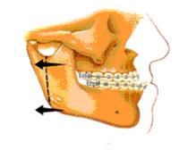Oral and Maxillofacial Surgery