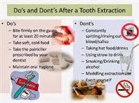 Do and Don’t after Oral Surgery Procedures: