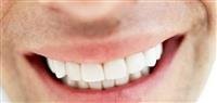 Fixed dentures