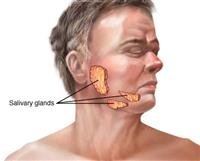 Dry mouth