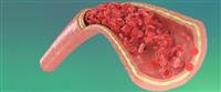 Reconstructive Pelvic Surgery