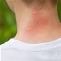 Ear Infections - Surgery