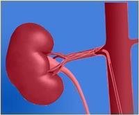 Young Teens at Risk of Kidney Transplant Failure